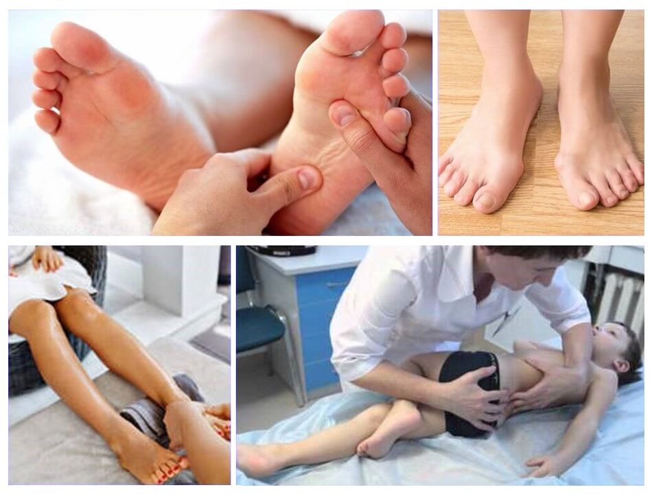 Deformazione Valgus nel trattamento dei bambini