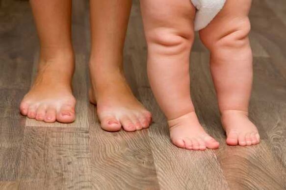 Valgus Deformation nei bambini
